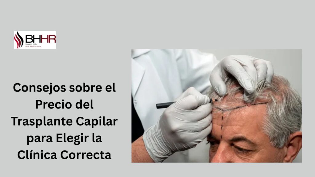 trasplante de cabello precio