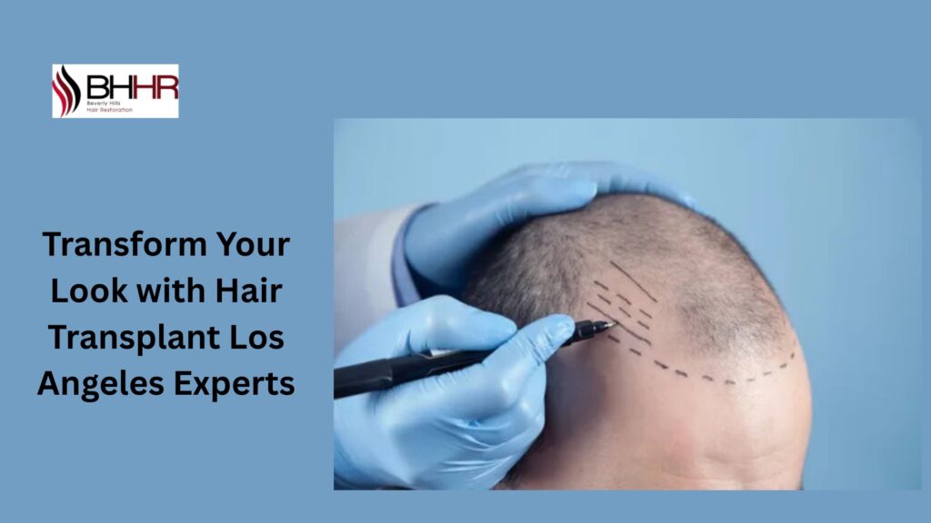 hair transplant los angeles