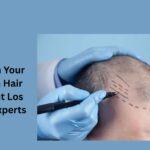 hair transplant los angeles
